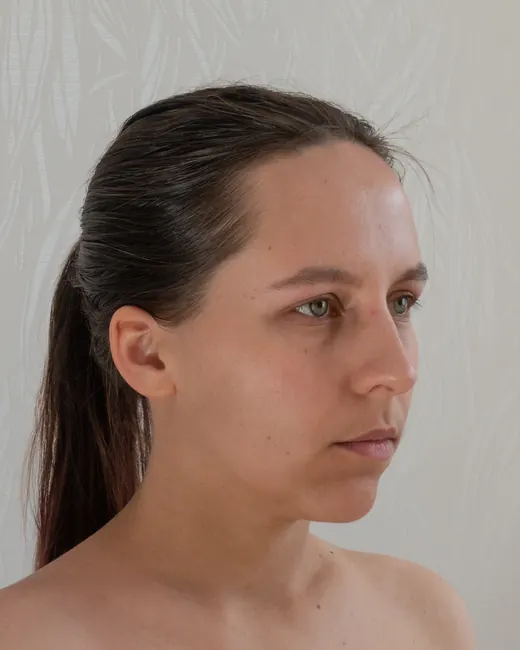 Reference photo: the head turned to one side