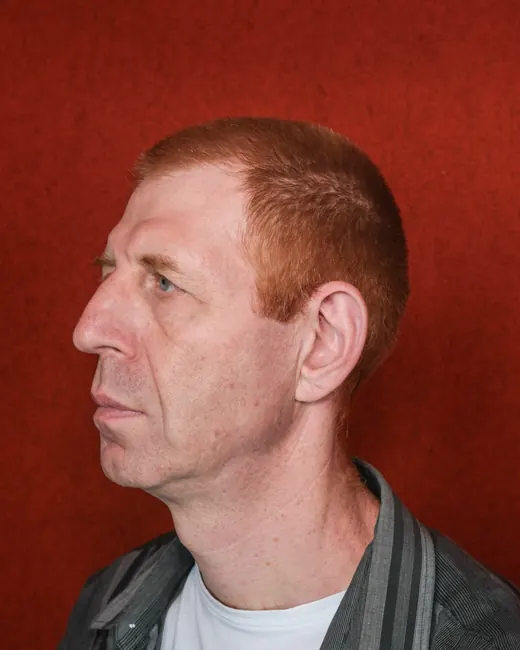 Reference photo: the head turned to the other side