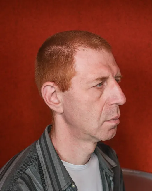 Reference photo: the head turned to one side